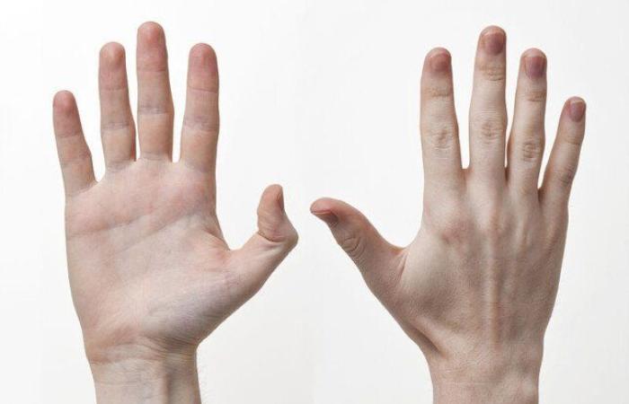 يفعلها البعض بأصابعهم.. عادة خاطئة قد تجعلك تجري عملية جراحية