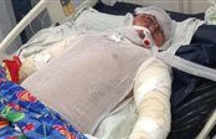 وفاة بطل حريق محطة مترو شبرا الخيمة الذي إنقاذ أرواح من الموت