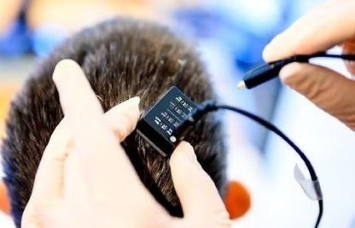 علماء يطورون أول شريحة دماغية لترجمة الأفكار إلى كلمات منطوقة