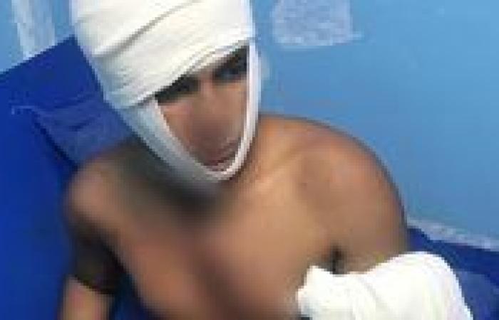 طالب يعتدي على صديقه بسلاح أبيض في شبرا الخيمة بسبب خلاف على هاتف