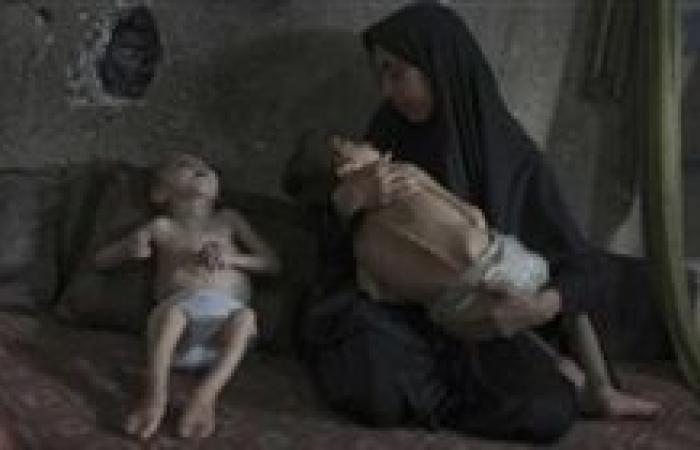 مفوض الأونروا: المجاعة فى غزة متعمدة والغذاء يستخدم كسلاح حرب