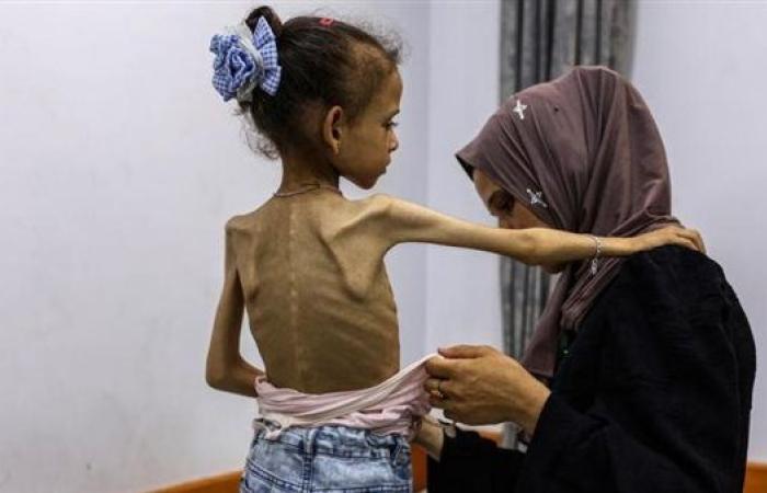 الصحة العالمية: أكثر من 15 ألف شخص في غزة بحاجة لإجلاء طبي