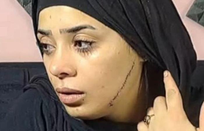 استمرار حبس المتهمة بتشويه وجه فتاة في مصر القديمة