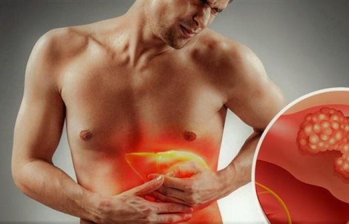 فيروس التهاب الكبد B.. مرض صامت وأعراضه تظهر بعد سنوات