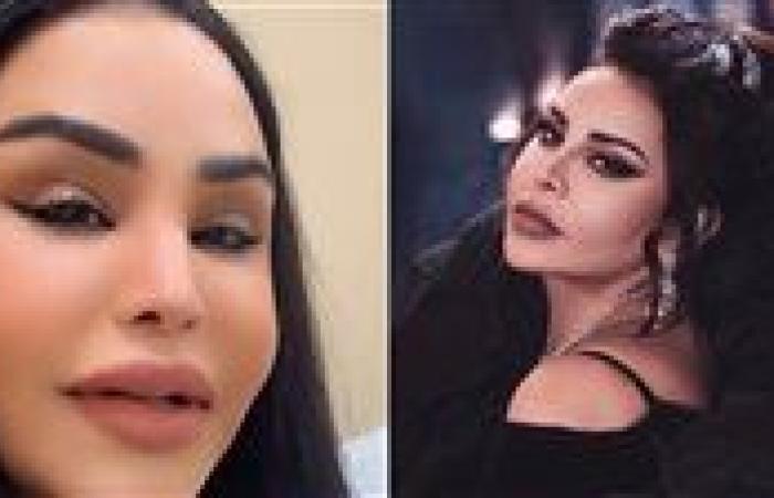 أحلام تكشف تفاصيل عملية تجميل أنفها: سعيدة بالنتيجة بعد 3 أشهر
