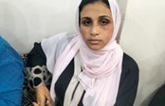 كان عايز يموتني .. «شريهان» من الشرقية تكشف تفاصيل اعتداء زوجها عليها بالضرب والخنق